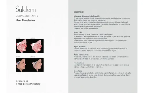 Sulderm Despigmentante Nocturno Sin Fragancia Niacinamida Vit C 30g