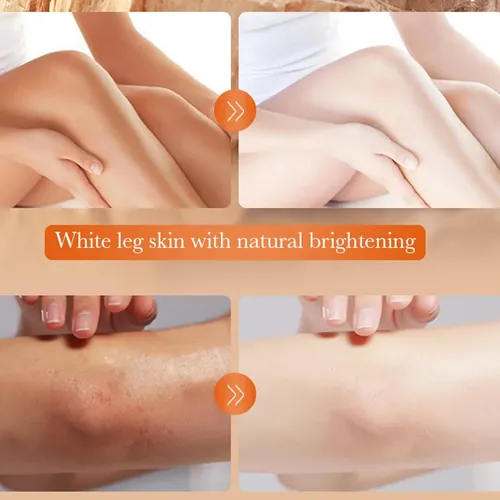 5.2oz Large Dark Knuckle Whitening Cream,skin Bleaching For