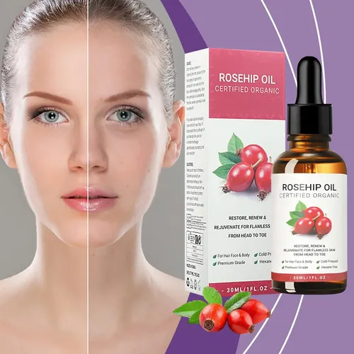 Aceite Rosa Mosqueta Hidratante Piel Rostro Cara 30ml