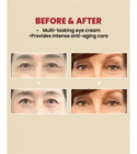 Crema De Ojos Ksecret Seúl 1988:4% De Retina Liposomal B  Todo Tipo De Piel Día/noche