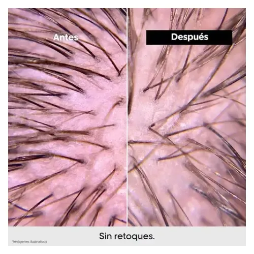 Shampoo Anti Irritación L’Oréal Professionnel Scalp 300ml