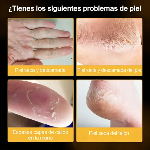 Crema Hidratante Para El Cuidado De Los Pies, Agrietadas Y A Limón