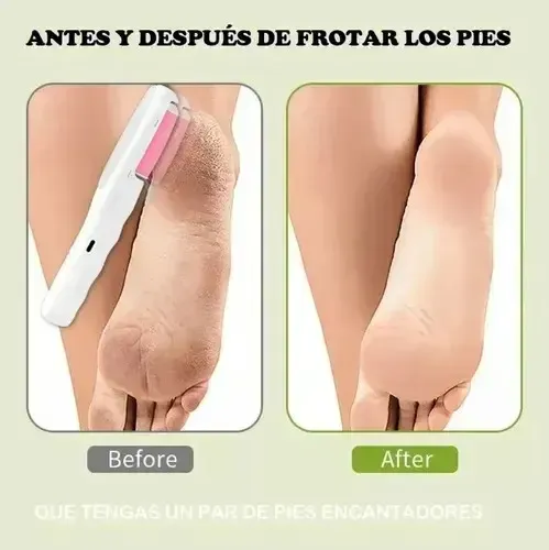 Depiladora Magica Y Exfoliador De Pies 2 En 1 Electrica