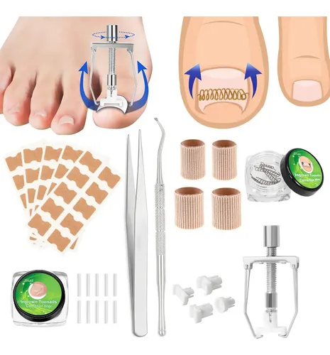 Set De Tratamiento Corrector De Uñas Encarnadas De Acero Ino