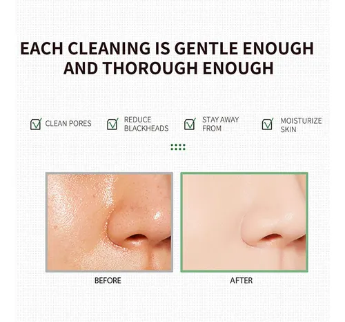 Mascarilla Removedora De Puntos Negros Creative Green Para R