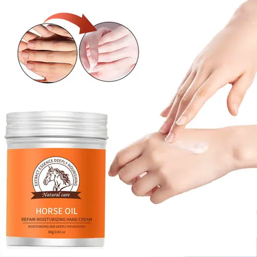 La Crema Antipecas Para Manos Restaura La Piel, Hidrata Y Pr