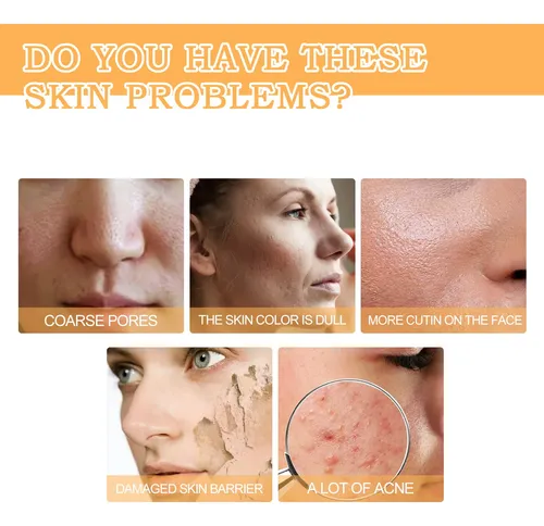 Tónico Facial Eelhoe Ácido Glicólico 7% 100ml Todo Tipo De Piel Día/noche