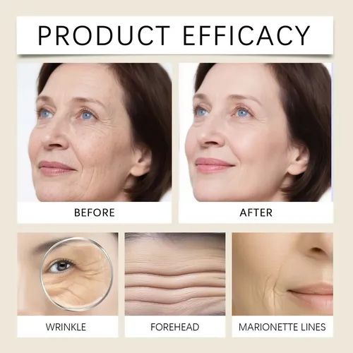Crema Antiarrugas Con Retinol, Loción Corporal Hidratante Y  Todo Tipo De Piel Día/noche