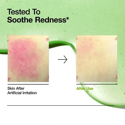 # Dark Spot Correcting Serum, Type S, 10% Niacinamide &