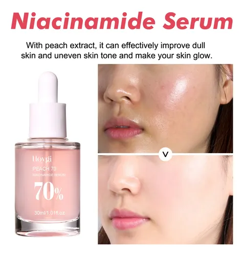 Serum Facial Niacinamida 70% Peach 30ml