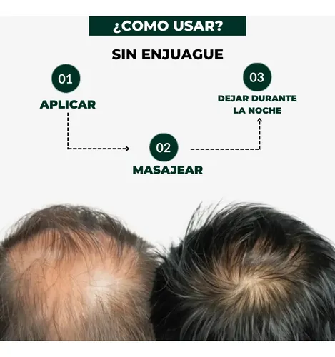 Kit Anticaida Serum Para El Cabello Cuidado Capilar 3 Meses