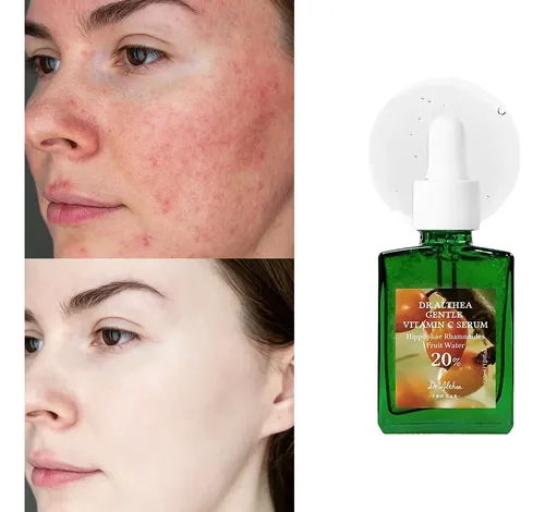 Sérum Facial Dr Althea Vitamina C 20% 30 Ml Todo Tipo De Piel Día/noche