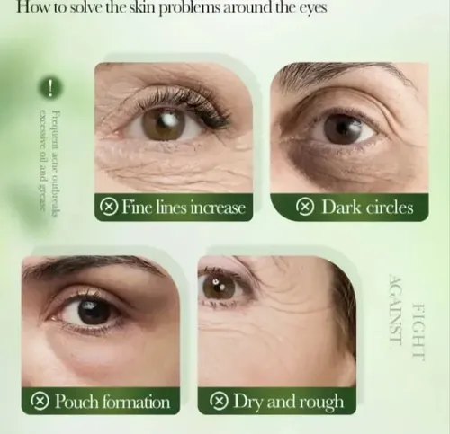 Crema Contorno Ojos Te Verde A Salicilico Antiojeras Sadoer Normal A Mixta Día/noche