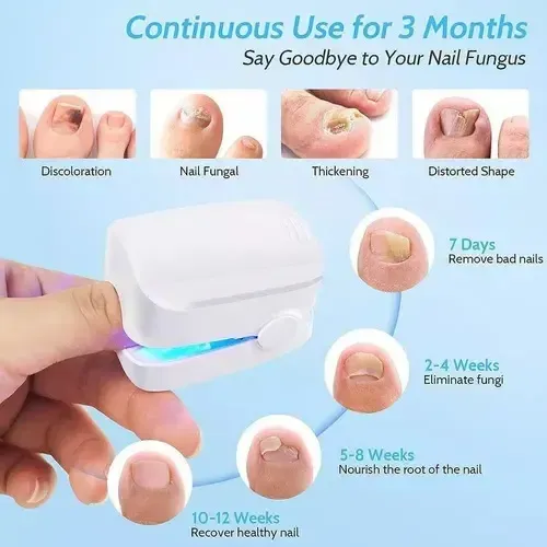 Manicura Lámpara Electrónica De Fototerapia Lámpara &av &ru