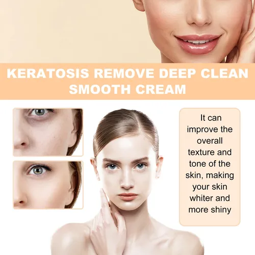 Crema Suave Y Limpiadora Profunda Ximonth Para Poros E Hidra