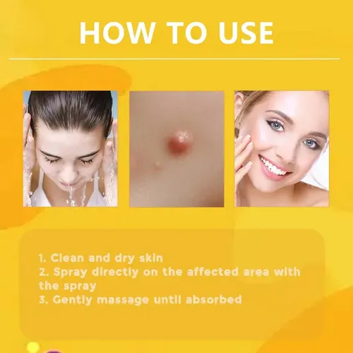 Gel De Crema Removedor De Verrugas Para Rostro Y Cuerpo, 3