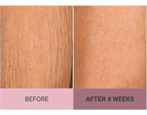 Consult Beaute Champagne Lift Crema Corporal 8 Oz Rosa
