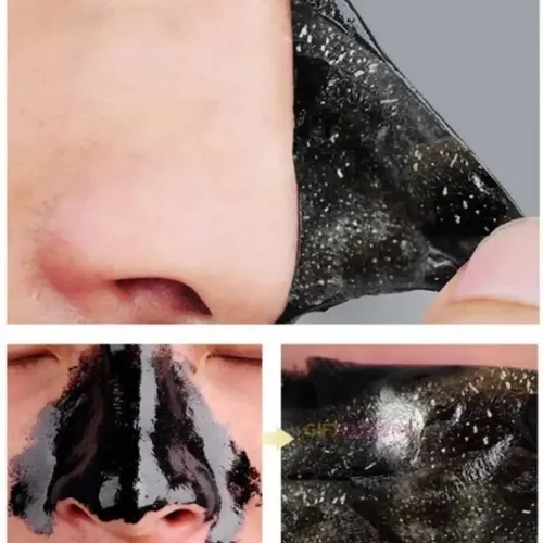 Set Mascarillas Faciales Removedor Puntos Negros Pack 30 Und