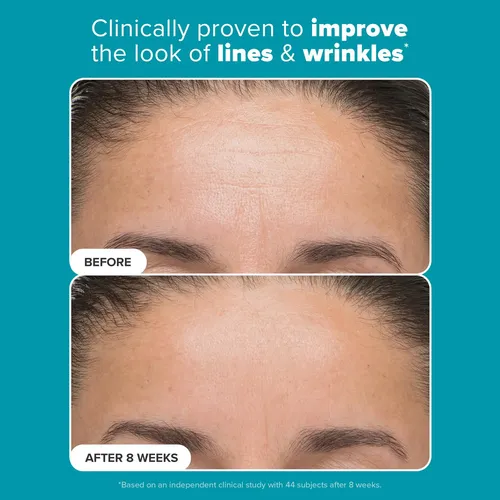 Exfoliante Paula’s Choice 6% De Ácido Mandélico Y 2% De Ácid