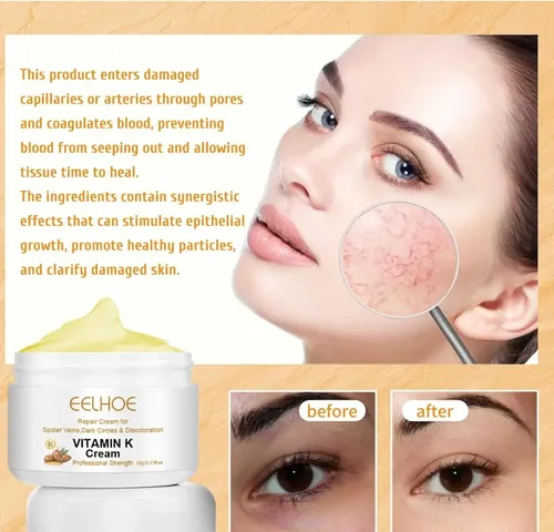 2 Unidades De Crema Milagrosa For Varices Con Vitamina K