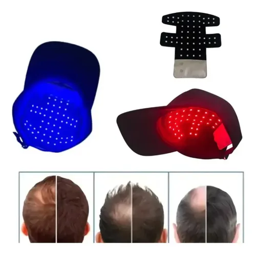 Gorra De Cuidado Capilar Con Luz Roja Led, Forma Perfecta