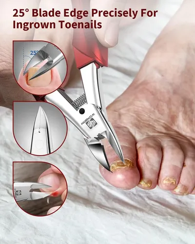 Wonsim Cortauñas De Uñas De Los Pies Para Uñas Gruesas, …