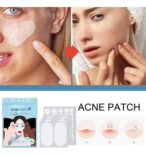 Patch Ii Pimple Acne De Tamaño Grande, 80 Unidades/juego