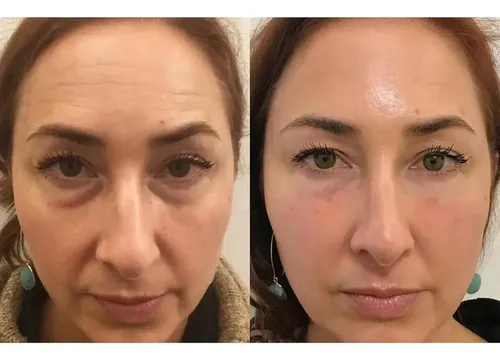 Crema For Ojos Celerty Eyegl Con Colágeno Y Aguacate