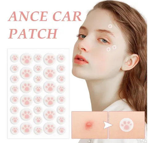 36 Unidades Cute Patch Cat Colorful Paw Pin Acne Ii