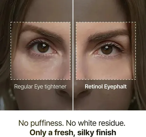 Dr.melaxin, Eyephalt, Retinol Eyebag Cream, 10 Gr