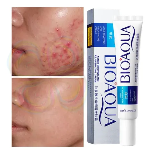 Crema Facial Para Puntos Negros, Antiacné, Cicatrices Y Poro