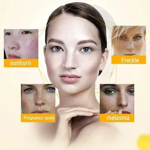 Wu- `pomada Facial Reparator For Branquear Manchas, .m