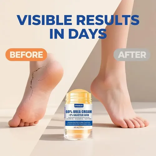 Stick de Crema para Pies con Urea 60% ZyraGloz Hidratación Profunda 40g
