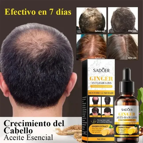 Sérum Jengibre Reparador Capilar Crecimiento Anticaída 30ml