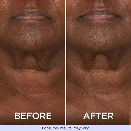 (vip) // Crema Reafirmante De Cuello Gopure 1pcs A