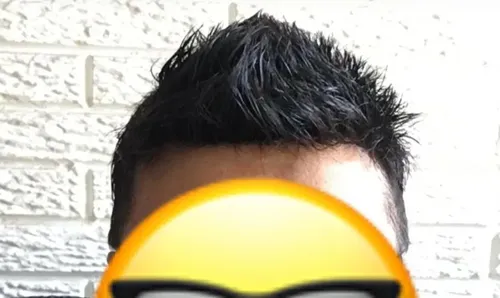 Protesis Capilar Indetectable Cabello 100% Humano Negro