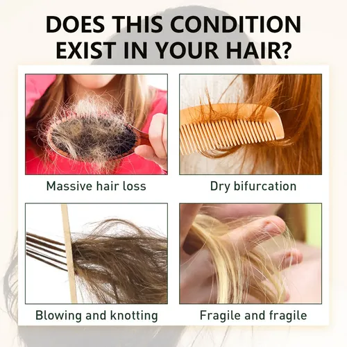 Sérum Capilar De Jengibre Eelhoe Para Un Cabello Más Suave Y