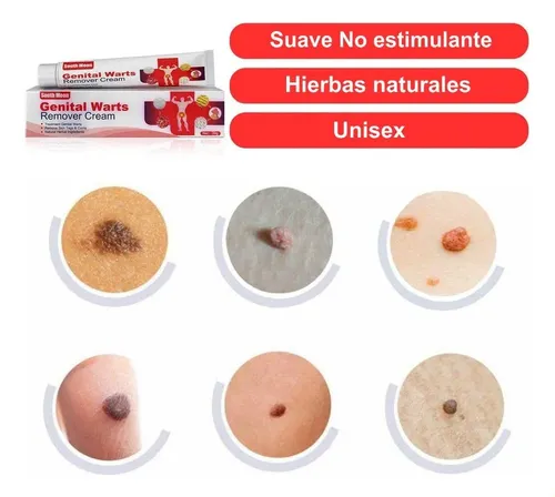Crema For Eliminar Verrugas, Crema For La Pie