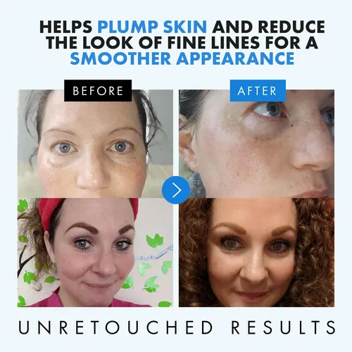 Sérum De Ácido Hialurónico Eclat Skincare Para Rostro, 1 Onz Todo Tipo De Piel Día/noche