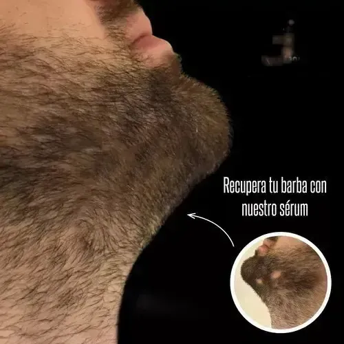 Sérum Cabello Anticaída Densidad Nutrición Cuidado Cabello @
