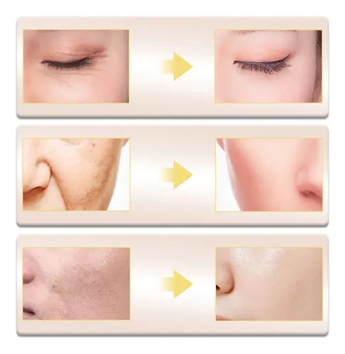 Esencia Facial Oscura Limpiadora, Iluminadora Y Reparadora,