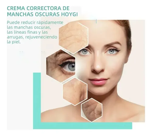 Ae La Crema Correctora De Manchas Aclara Las Manchas Oscuras