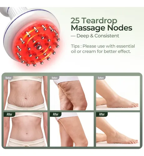 Masajeador Corporal Rollerstone Eléctrico 4 En 1 Gua Sha