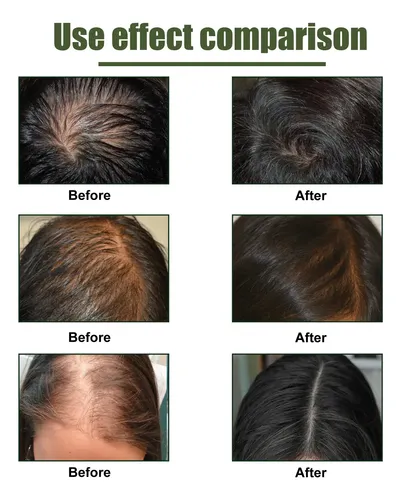 Aerosol Para Cabello Eelhoe Con Pomelo Para Brillo Y Volumen