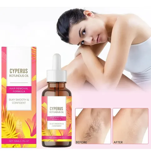 Aceite De Cyperus Rotundus Para Depilación 60 Ml