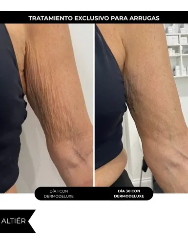 Crema Anticelulitis Antiarrugas Y Reafirmante Altier
