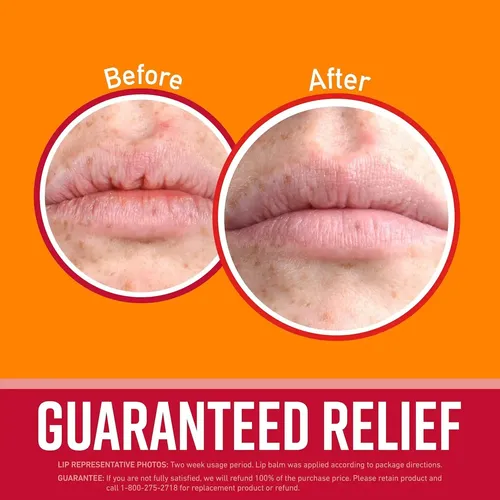 Bálsamo Labial O’keeffe’s Cherry & Vitamin E X 3 Unidades Us