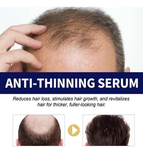 El Sérum Reparador Capilar Eelhoe Hidrata Y Nutre El Cabello