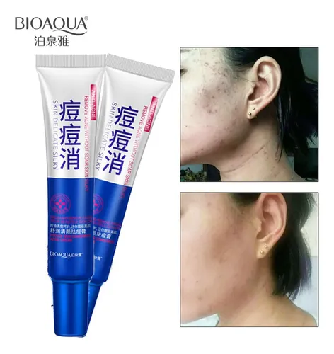 Crema Limpiadora Bioaqua Acne Treatment Pa Skin Care