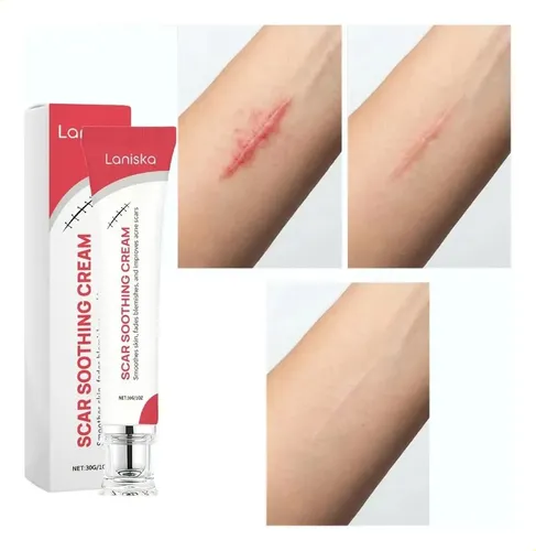Crema Para Cicatrices Laniska Calmante 30 G Neutra